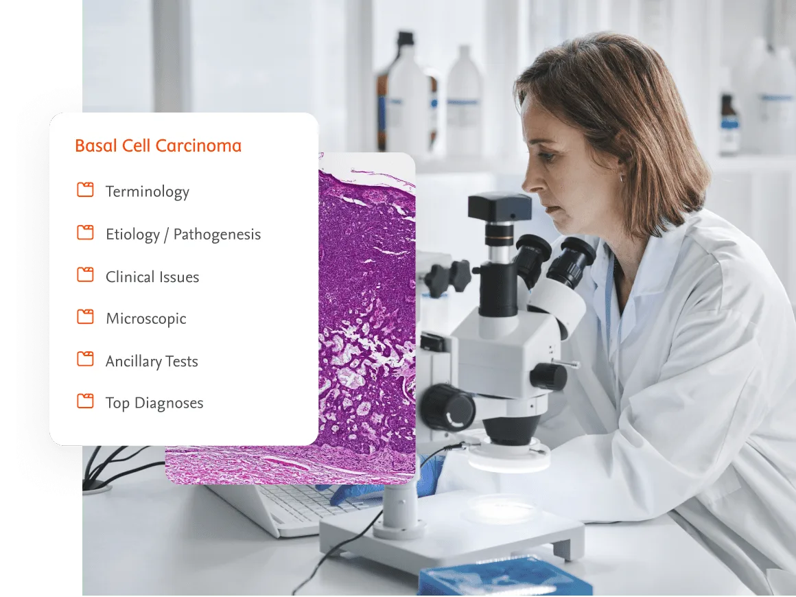 Doctor using microscope with overlay of basal cell carsinoma content